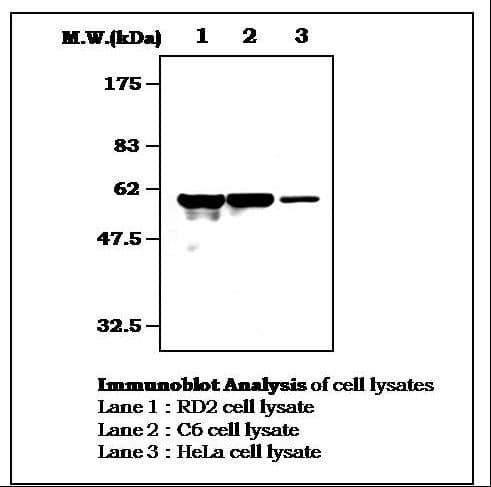 PathPlus™ Vimentin Antibody (clone 23H2)
