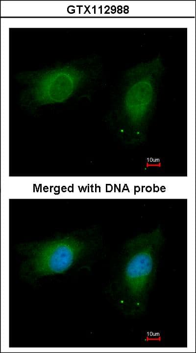 NME1 / NM23 Antibody