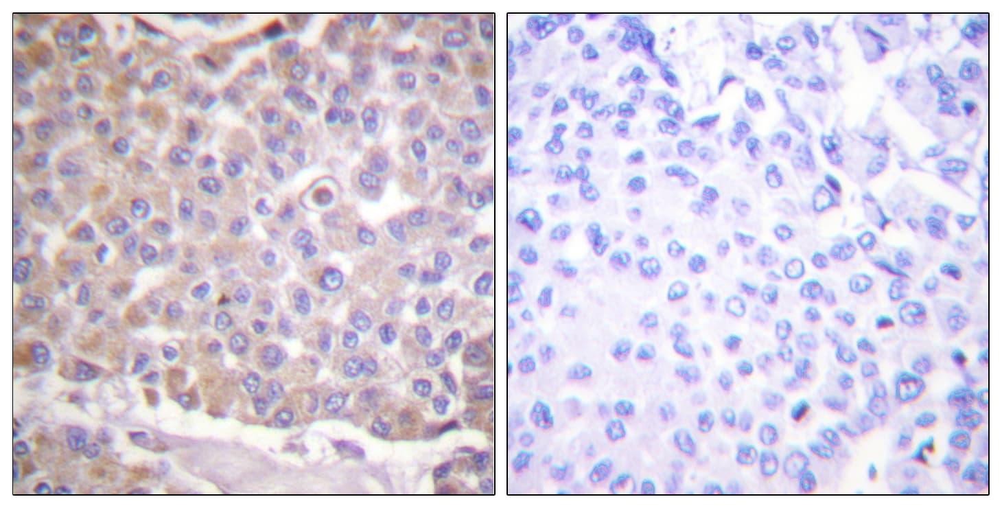 IRS1 Antibody (aa1067-1116)