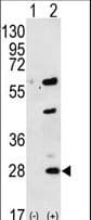 Polyclonal Rabbit anti-Human GREM1 / Gremlin-1 Antibody (aa111-139, WB)