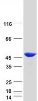Human CAPG Protein (Recombinant Myc-DDK (Flag))