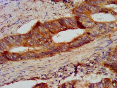 CSN2 / Beta Casein Antibody