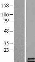 PTH2 / Parathyroid Hormone 2 Protein (Over-Expression Lysate Myc-DDK (Flag))