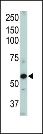 ACVRL1 Antibody (aa38-68)