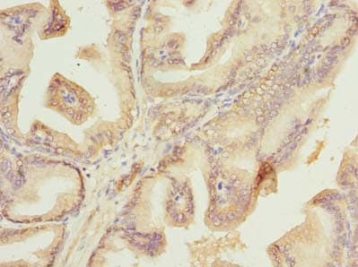 Polyclonal Rabbit anti-Mouse PLET1 / C11orf34 Antibody (IHC, WB)