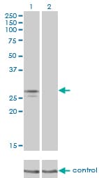 NDUFS3 Antibody (clone 1D6)