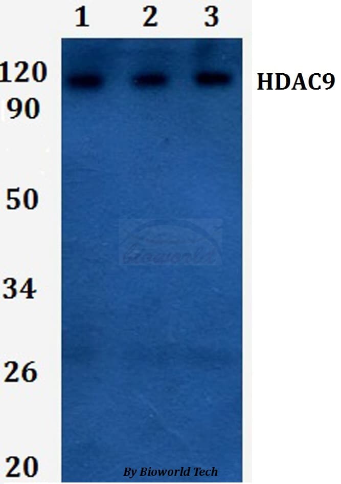 Polyclonal Rabbit anti-Human HDAC9 Antibody (WB)