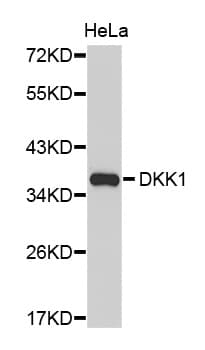 Polyclonal Rabbit anti-Human DKK1 Antibody (aa71-266, WB)