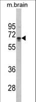 IHC-plus™ ZMYND11 / BS69 Antibody (aa152-180)