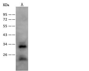 Polyclonal Rabbit anti-Human NRM Antibody (Preservative Free, IHC, WB)