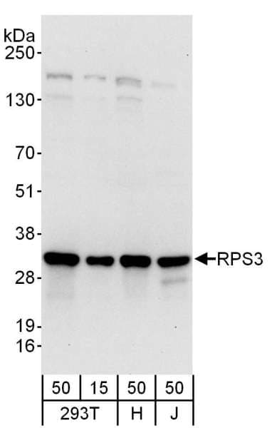 IHC-plus™ Polyclonal Rabbit anti-Human RPS3 / Ribosomal Protein S3 Antibody (aa1-50, IHC, WB)