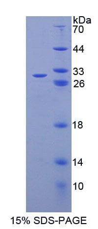 Mouse ABCC6 / MRP6 Protein (Recombinant His-T7, N-terminus)