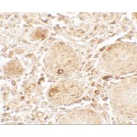 LAMTOR1 Antibody