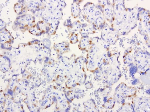 IRF6 Antibody (clone UMAB106)