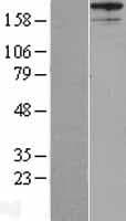 Human Gravin / AKAP12 Protein (Over-Expression Lysate Myc-DDK (Flag))
