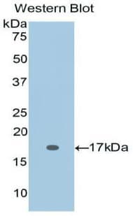 IL2 Antibody (aa21-153)