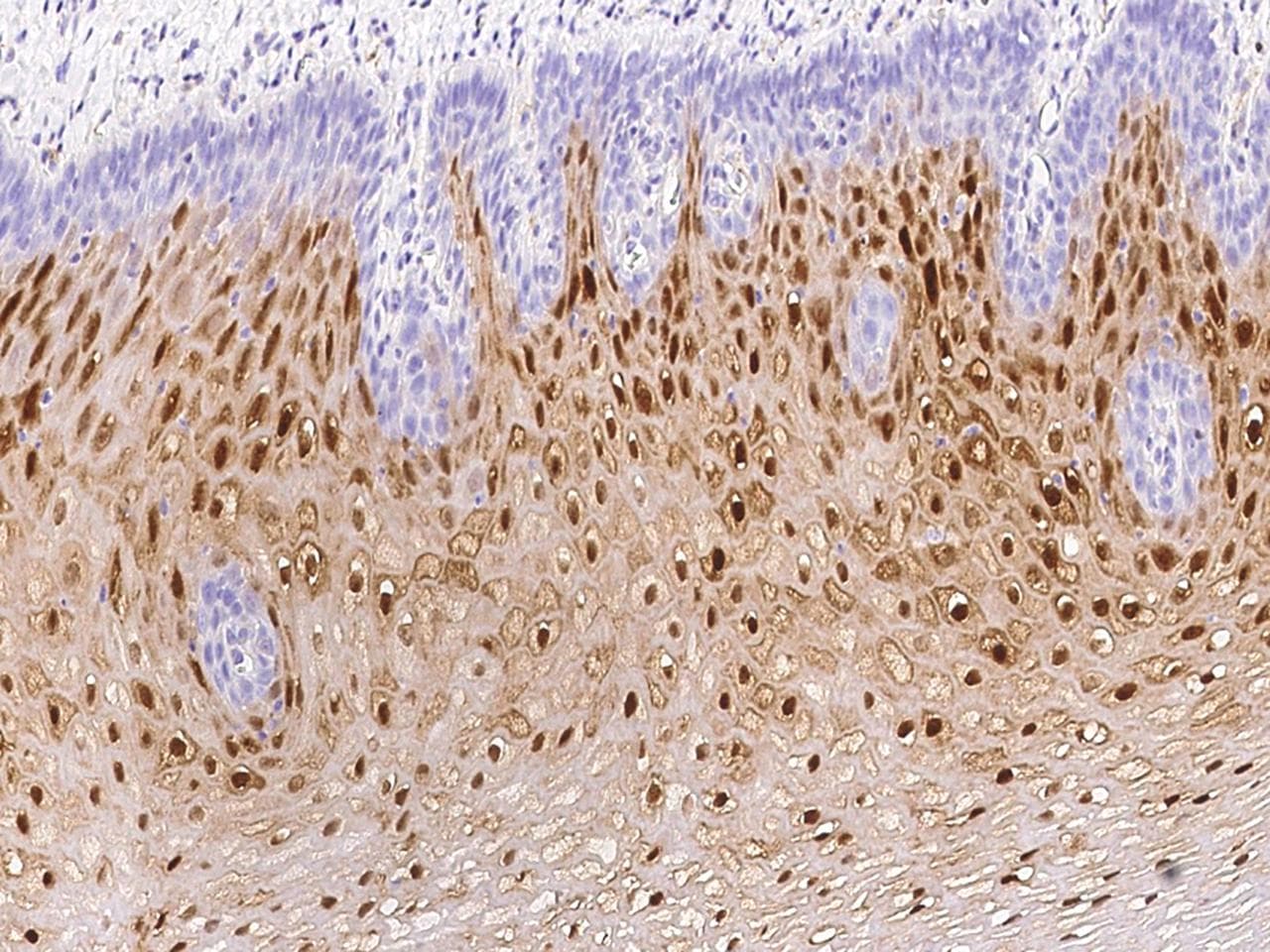 SERPINB3 Antibody
