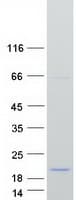 Human PDCD5 Protein (Recombinant Myc-DDK (Flag))