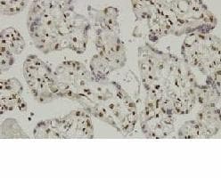 Polyclonal Rabbit anti-Human CBFA1 / RUNX2 Antibody (Asp198, IHC, WB)