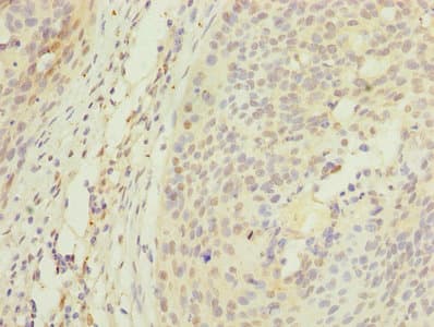 Polyclonal Rabbit anti-Human APEX1 / APE1 Antibody (WB)