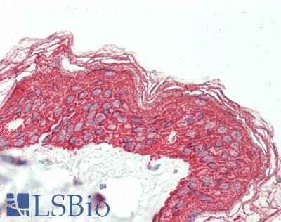 Polyclonal Rabbit anti-Human LETMD1 / HCCR1 Antibody (aa271-320, IHC, WB)