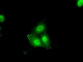 ERCC1 Antibody (clone OTI1C6)