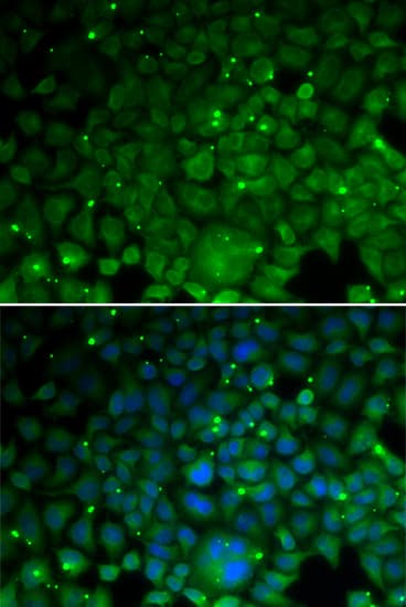 CRYAA / Alpha A Crystallin Antibody