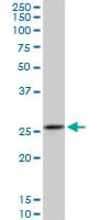 CAPNS1 / CAPN4 Antibody (clone 3C4)