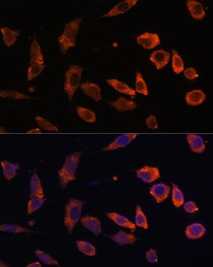 Polyclonal Rabbit anti-Human RAB5B Antibody (IF)