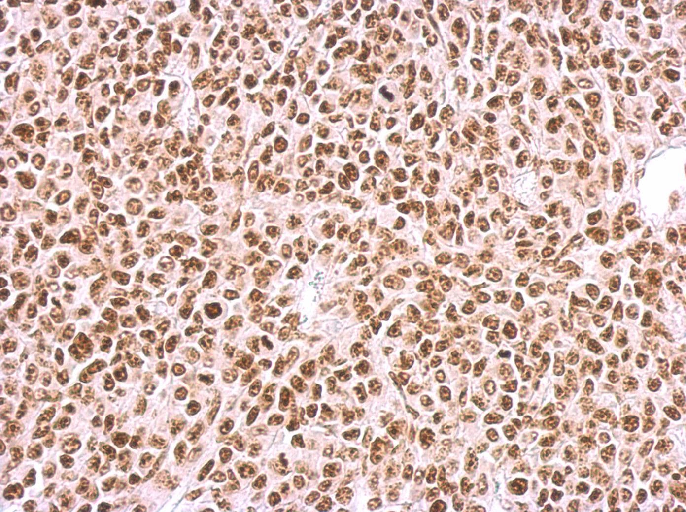 Polyclonal Rabbit anti-Human BCCIP Antibody (aa181-273, IHC, WB)