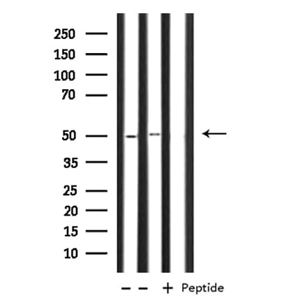 Polyclonal Rabbit anti-Human OAT Antibody (IF, WB)
