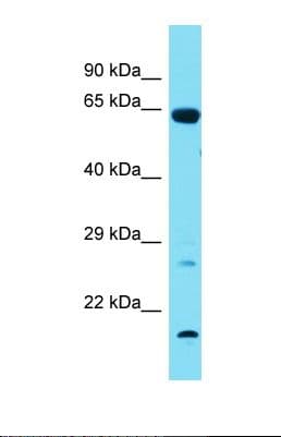 TBX18 Antibody (aa85-134)