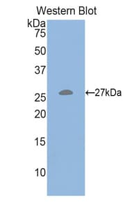 HGF / Hepatocyte Growth Factor Antibody (aa482-710)