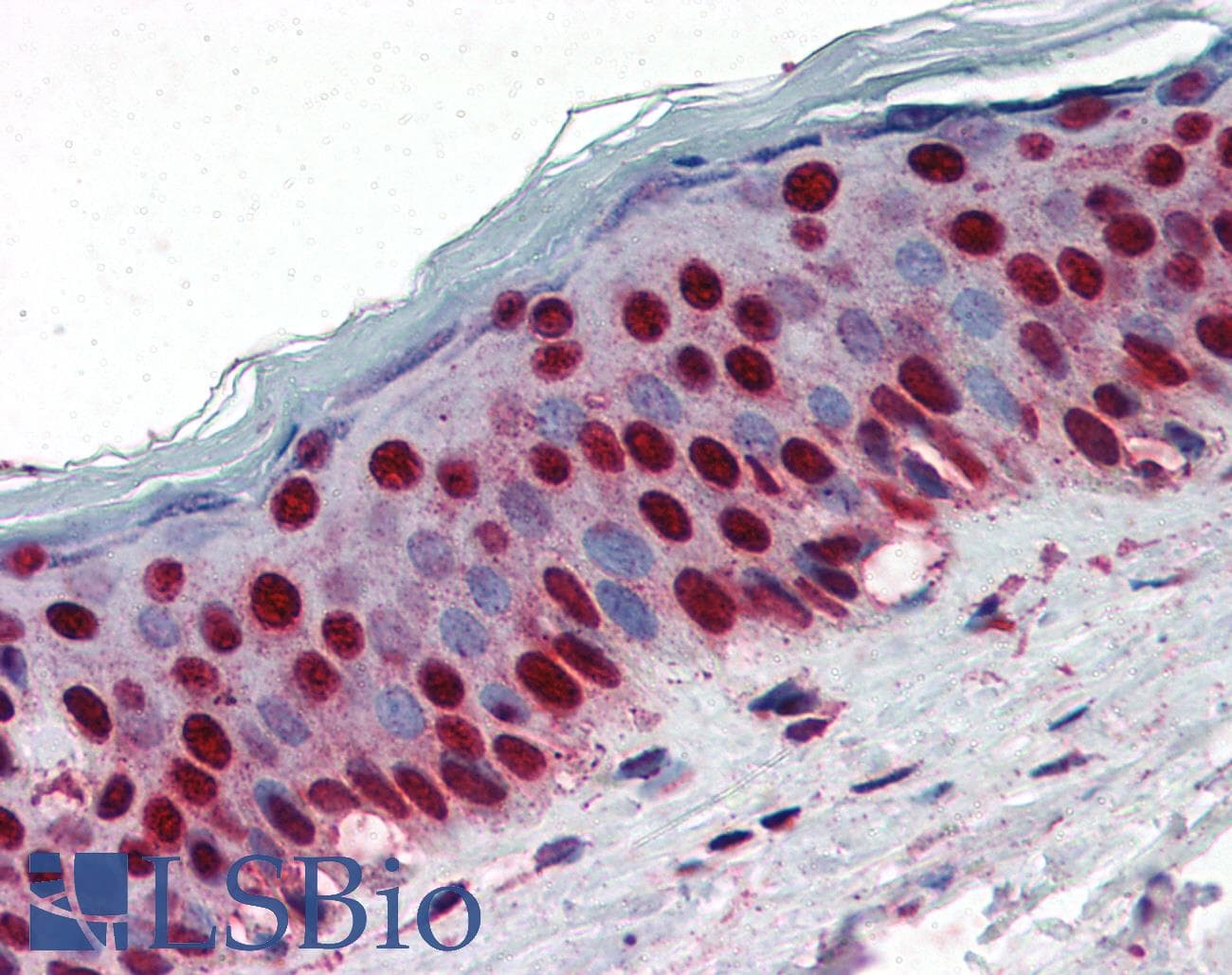 IHC-plus™ NPM1 / NPM / Nucleophosmin Antibody (aa81-294, clone 5E3)