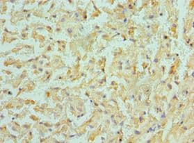 Polyclonal Rabbit anti-Human BMF Antibody (aa1-184, IHC)