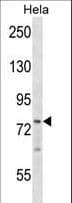 BRF1 Antibody (aa314-342)
