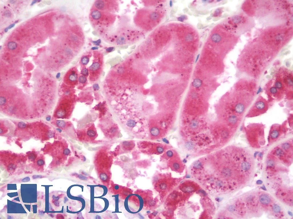 IHC-plus™ Polyclonal Goat anti-Human PDIA3 / ERp57 Antibody (C-Terminus, IHC, IF, WB)