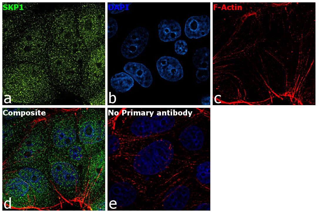SKP1 Antibody (clone 4E+11)