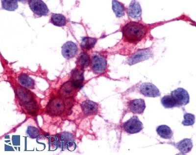 IHC-plus™ Polyclonal Rabbit anti-Human MCHR2 Antibody (C-Terminus, IHC)