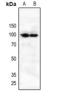 IL21 Receptor Antibody