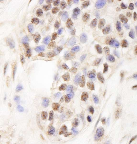 TCAB1 / WDR79 Antibody (aa1-50)
