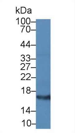 Procalcitonin Antibody (aa26-141)