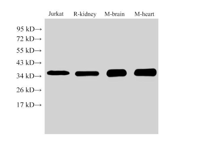 LDHB / Lactate Dehydrogenase B Antibody