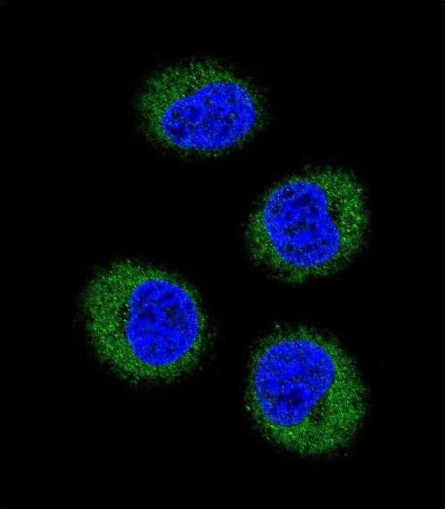 FGR Antibody (aa3-33)