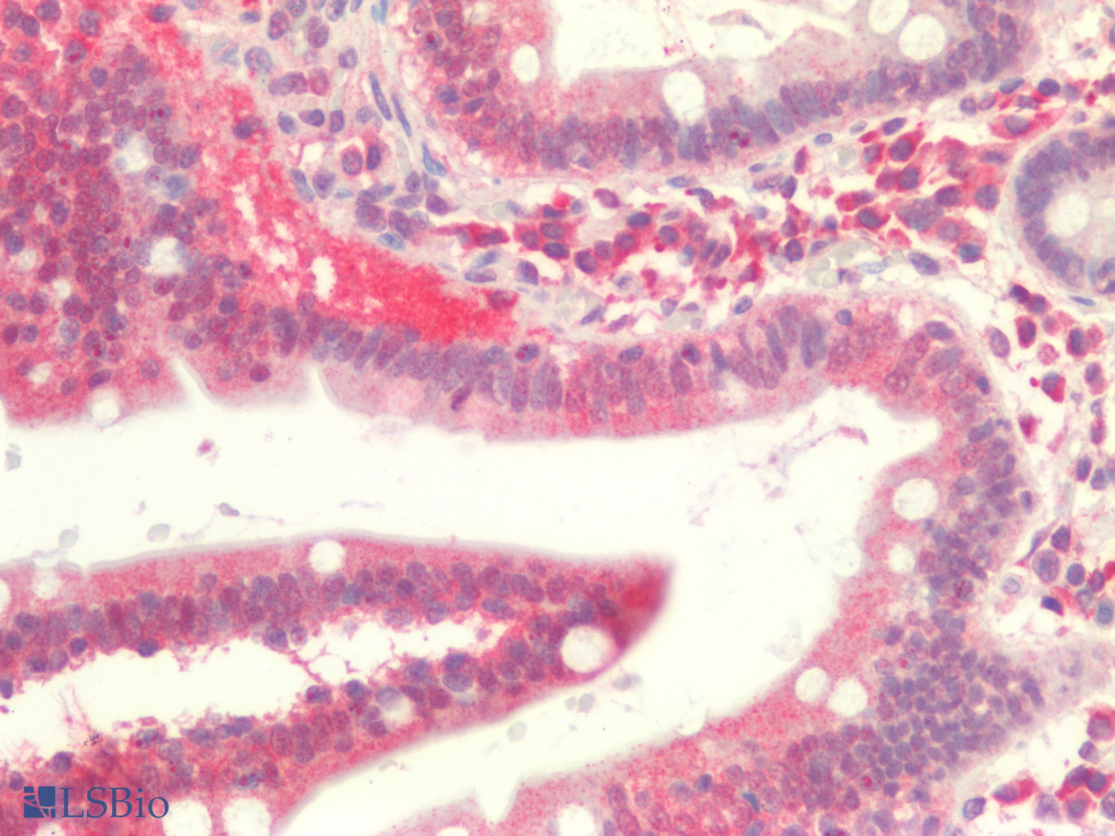 PathPlus™ TGFB1 / TGF Beta 1 Antibody