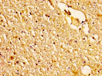 NDUFS2 Antibody