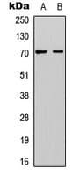 EYA1 Antibody (Internal)