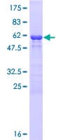 Human FAM192A / Nip30 Protein (Recombinant GST)