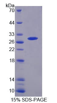 Human PSMB6 Protein (Recombinant His)