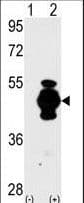 GFAP Antibody (aa10-40)